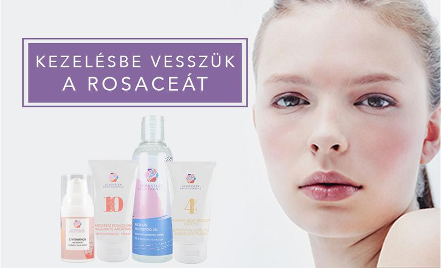 Rosacea kezelésére kozmetikumok - csak természetesen!