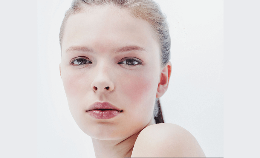 Rosacea kezelésére krém - csak természetesen!