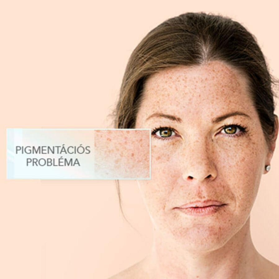 Nr.6 Schüssler natúr arckrém pigmentációs problémákra